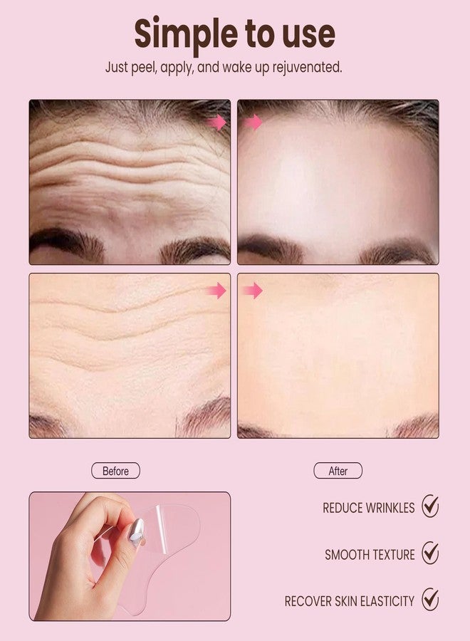 Yargkos 3 Pcs Forehead Wrinkles Patches Reusable, Anti Wrinkle Patch for Fine Lines, Hypoallergenic Wrinkle Remover Mask, Silicone Face Tape for Wrinkle Reducer, Women Facial Kit for Beauty Skincare - Image 2